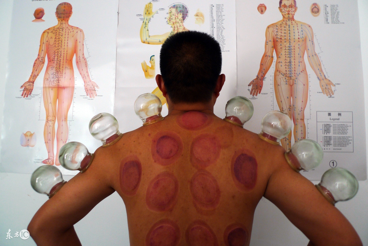 女士祛除湿气一般拔罐多久,拔罐能祛除人体湿气吗