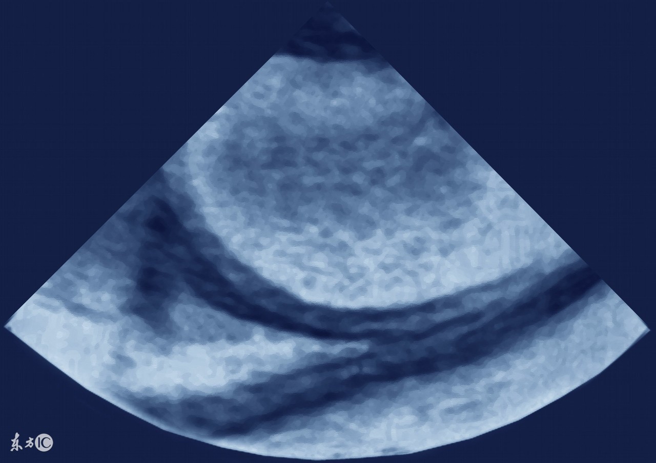 哪些癌症会引起腹水,什么癌症最容易出现胸腹水