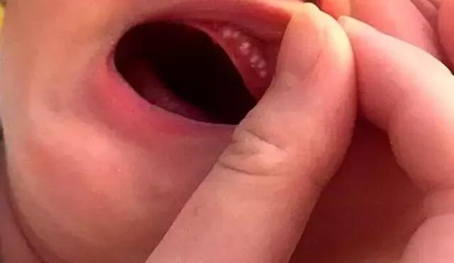 月嫂总结那些事：新生儿这28种情况是正常的