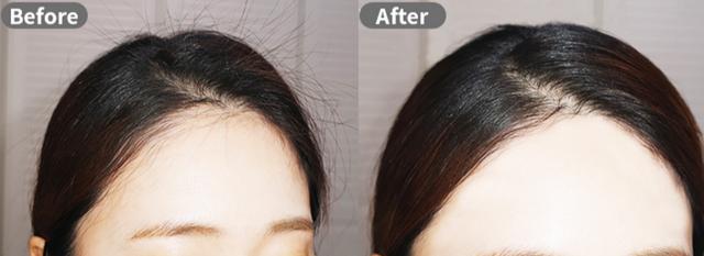 女孩头发毛躁碎发多炸毛怎么养护,女生头顶碎发多炸毛怎么处理