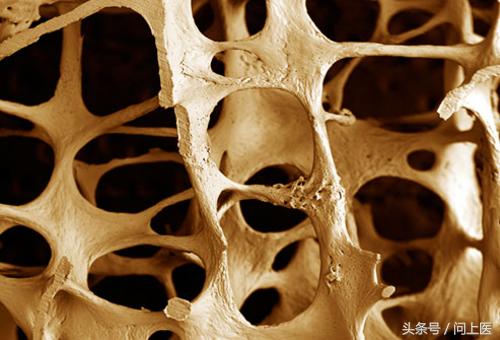 类固醇类药物是什么药,类固醇类药物有什么作用