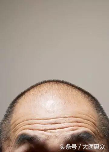 秀发三千，还是三万来着？我一根都不想掉！