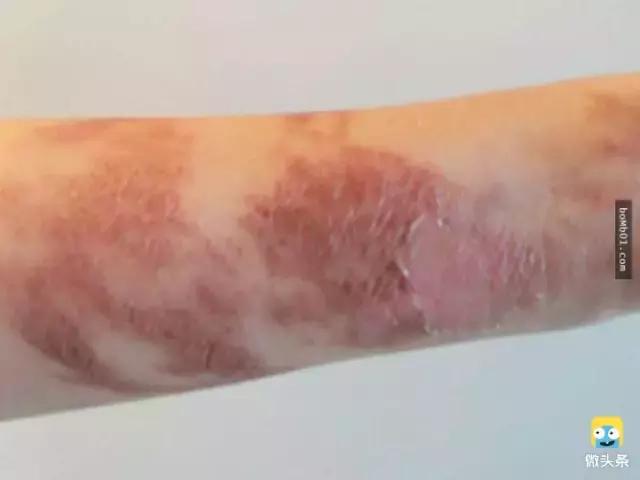 被雷劈是种什么样的体验？看完简直身受同感