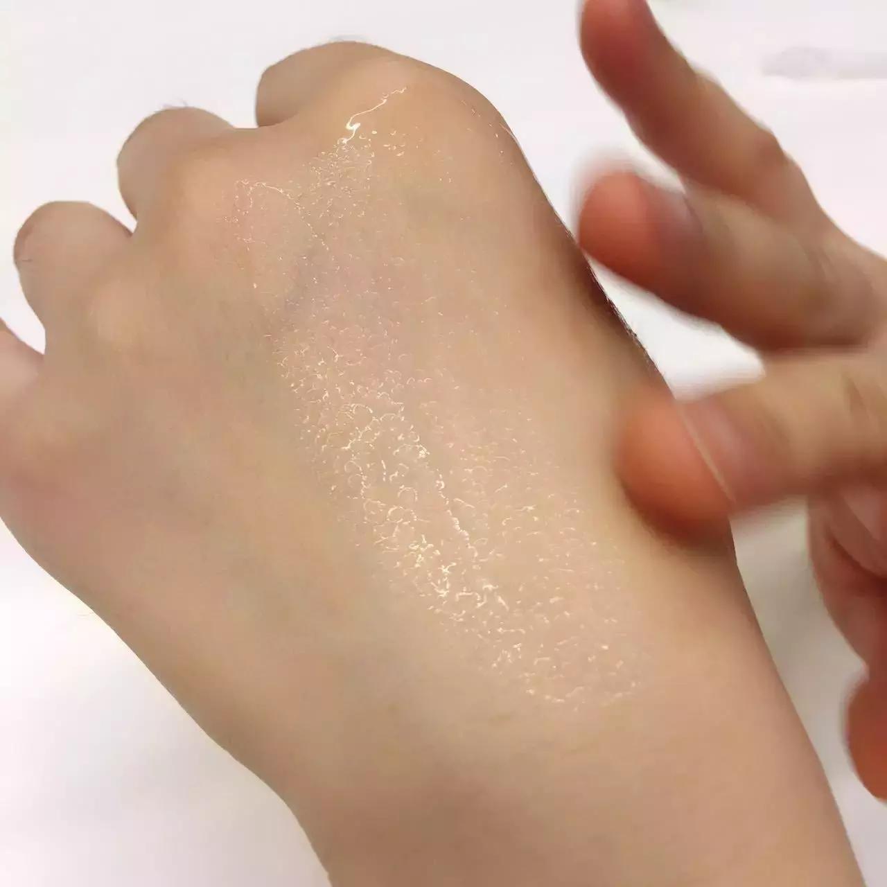 劲爆｜全球最牛X的5款玻尿酸大测评