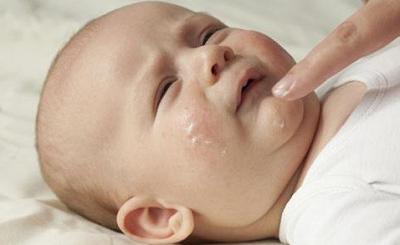 湿疹引起的皮肤瘙痒用什么药膏,湿疹皮肤瘙痒怎么治疗才能断根