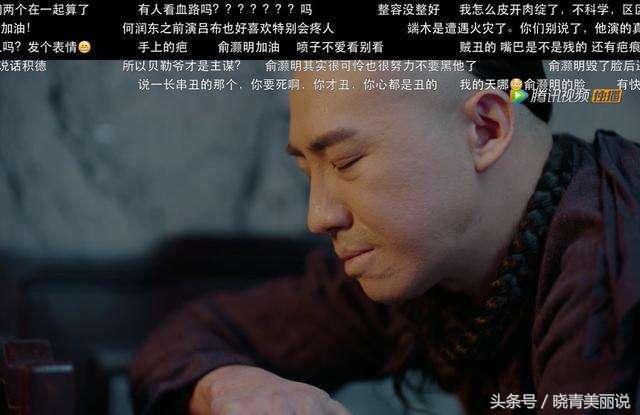 俞灏明被说丑悲伤,俞灏明烧伤后是怎么恢复的