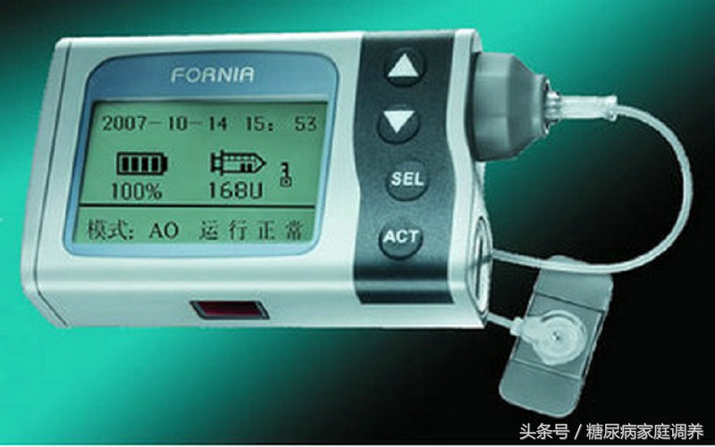 胰岛素泵的使用方法及注意事项,糖尿病患者用胰岛素应该注意什么