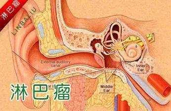 夺走高仓健、罗京的淋巴瘤，究竟是什么鬼？（附三甲医院名单）