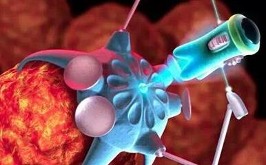 夺走高仓健、罗京的淋巴瘤，究竟是什么鬼？（附三甲医院名单）