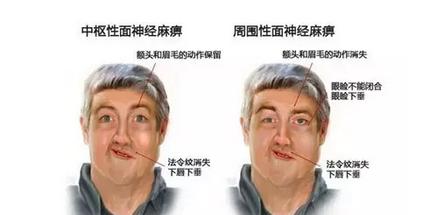 有专治半边瘫的医院吗,全国治半边瘫排名第一的医院