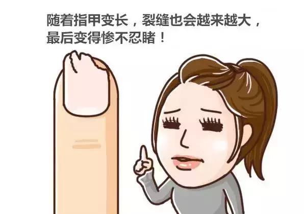 剪指甲的时候为什么会飞出去,为什么剪指甲指甲会乱飞
