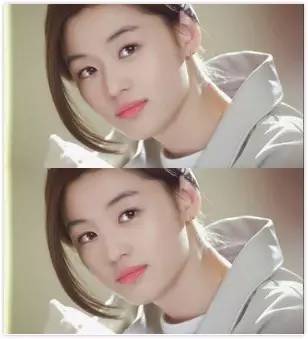 专家讲解明星微整形 (明星教你微整形)