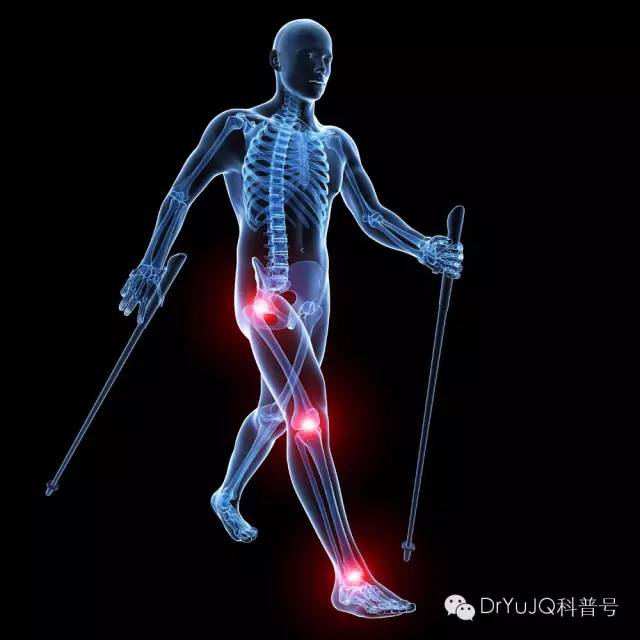 风湿免疫疾病吃中药有用吗,什么是风湿