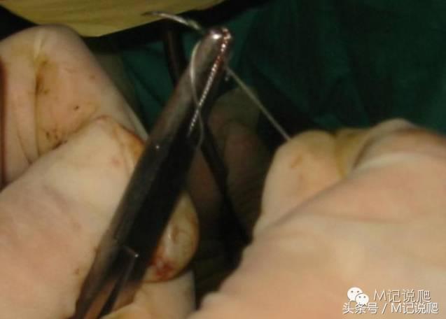 苏卡达陆龟乌龟卡脖子,苏卡达陆龟下颚裂开