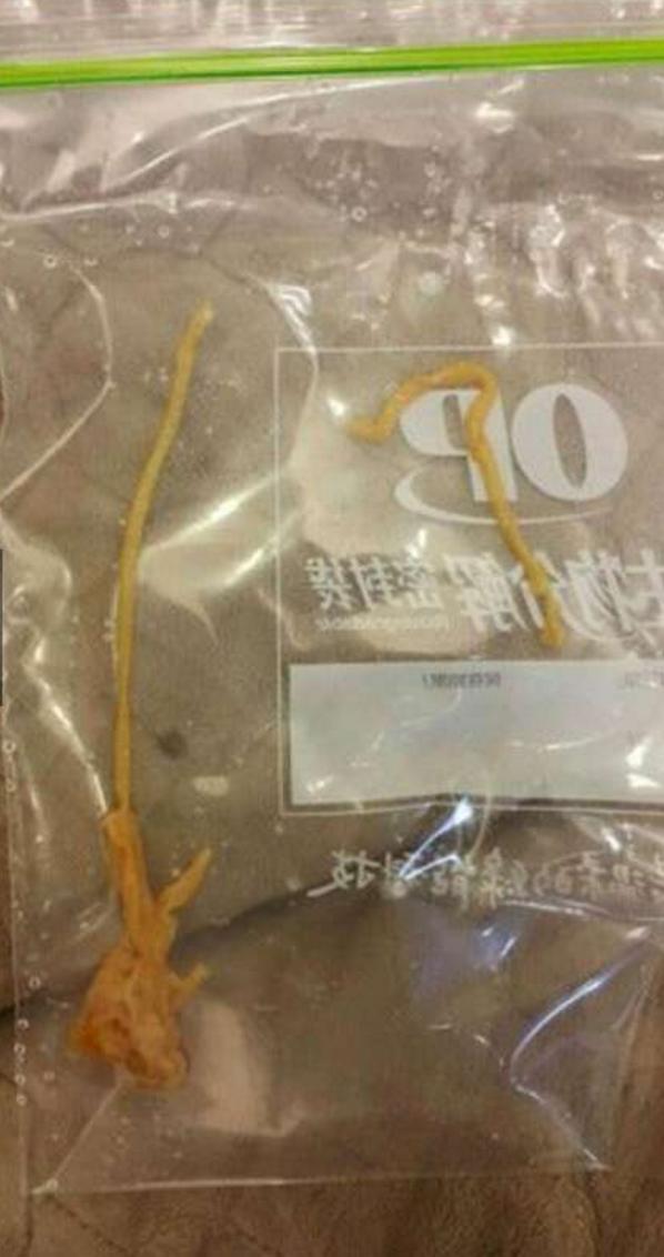 女士吃泻药腹泻不止,女生吃泻药突发腹泻