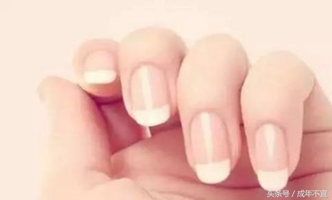 手指上没有半月牙是啥原因,手指半月牙代表什么