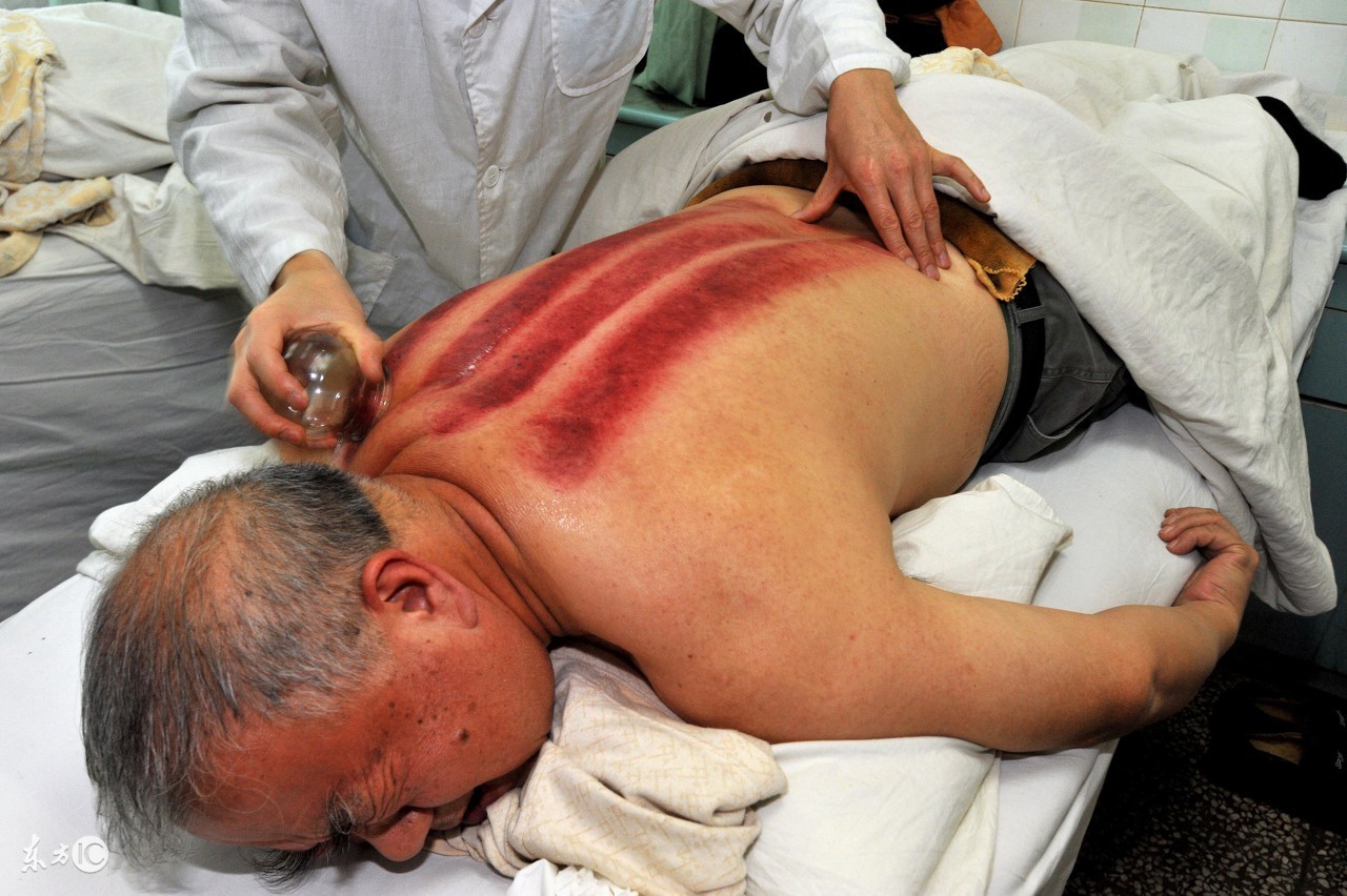 广东湿气太重怎么祛除,广东湿气大广东人怎么除湿的