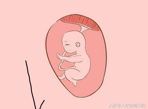 孕妈妈哪些动作会使胎宝宝缺氧,胎宝宝有什么表现