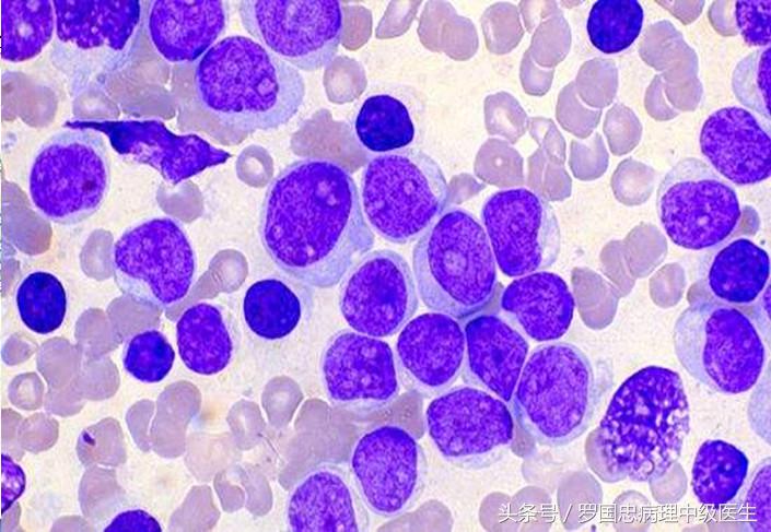 白血病康复案例,白血病病人痊愈后的总结