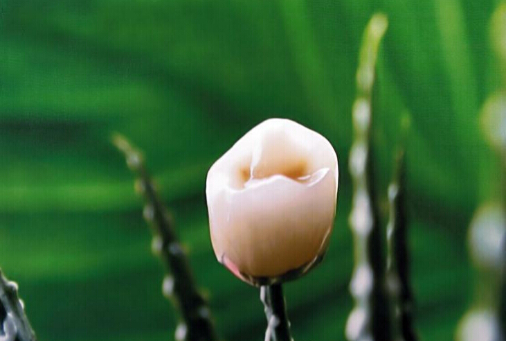 如何科学地选择烤瓷牙种类,护牙健齿的三大秘诀