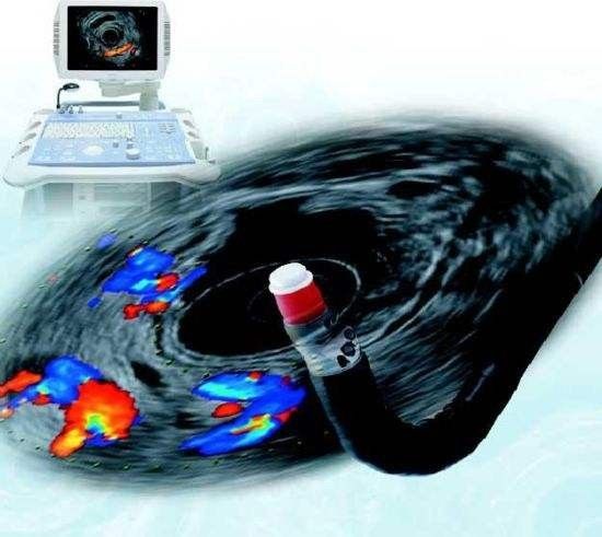 乔布斯胰腺癌为啥能活这么久,乔布斯得胰腺癌为什么活了那么久