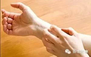 教你对付湿疹,别让湿疹误了宝宝颜值