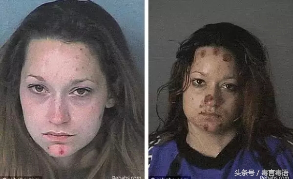 10个吸毒前后的惊人变化,吸毒的人吸毒前后对比图片