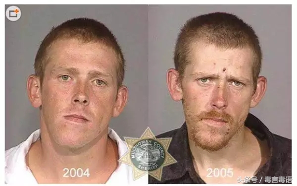 触目惊心吸毒前后真实的变化,吸毒的危害到底有多严重图片