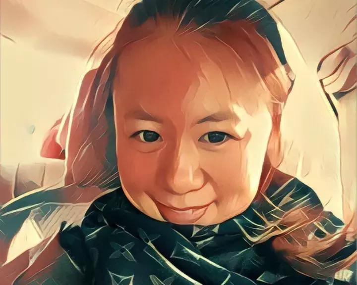 整容失败后的样貌,整容失败后才觉得自己没有丑