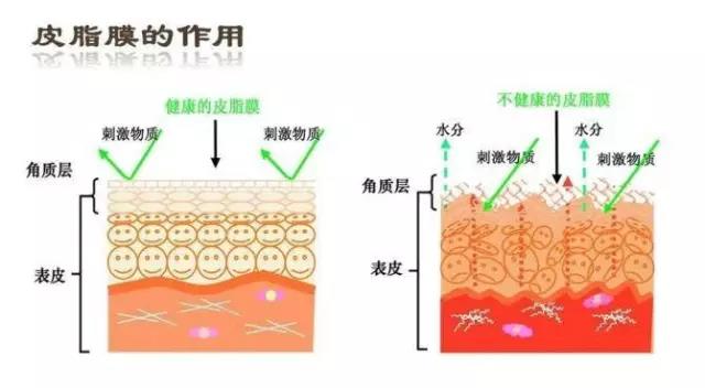 有红血丝是皮肤哪一层受损,皮肤敏感发红发痒是哪一层受损