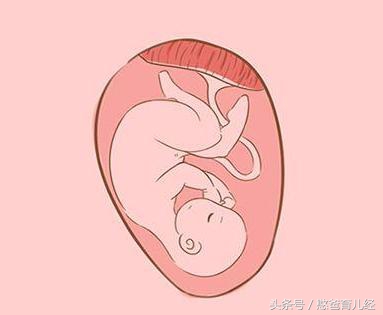 怀孕8个月胎位不正应该怎么办,怀孕8个多月胎位不正怎么办