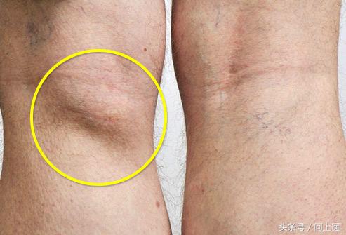 老年人膝盖疼痛的原因和解决方法,上楼梯膝盖疼痛的原因和解决方法