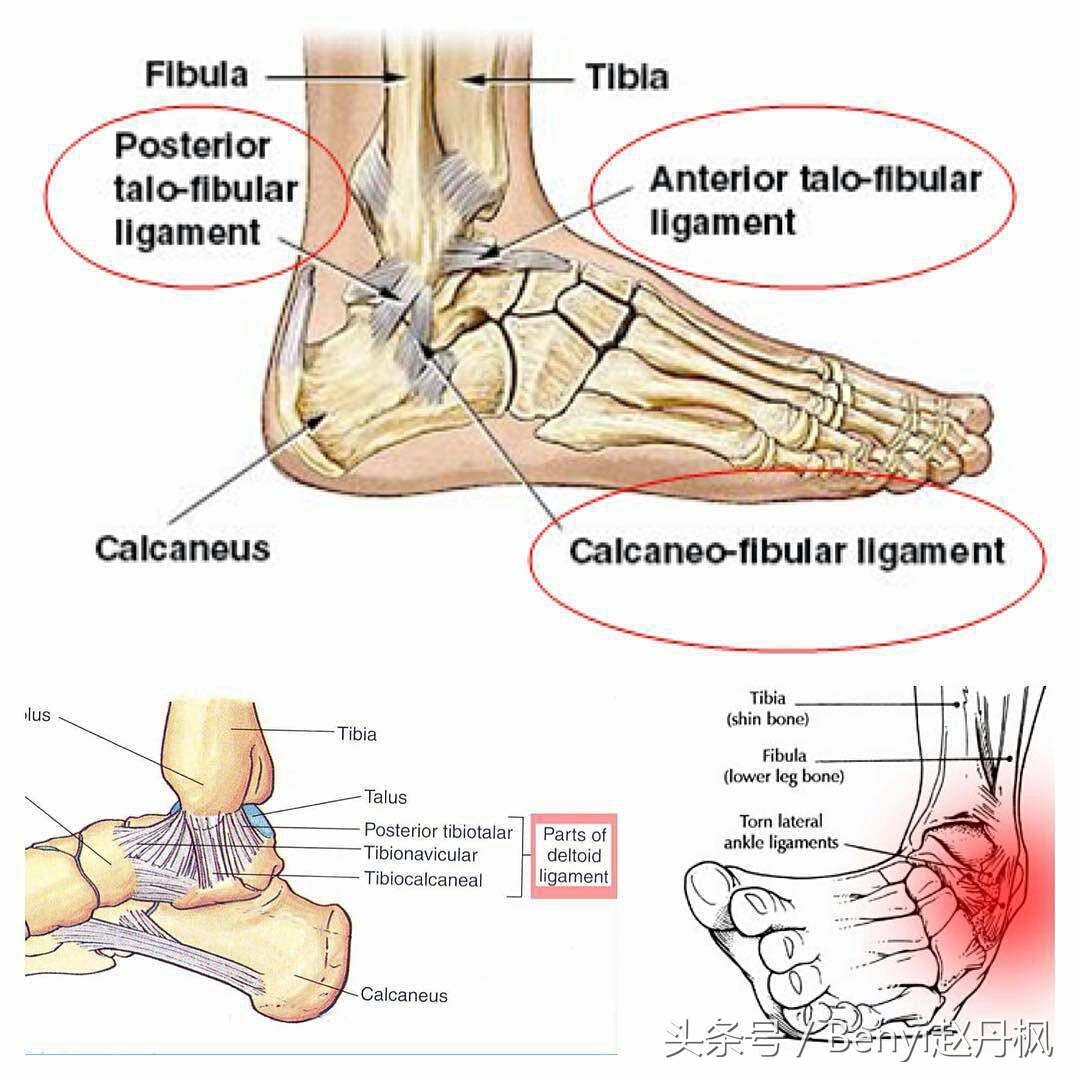 脚踝受伤半年后如何康复训练,脚踝伤病的六个问题