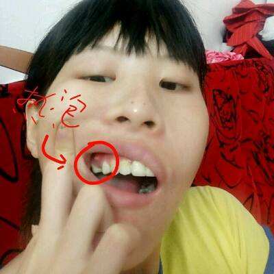 怀孕期很疼的人,怀孕期的孕妈会有很多症状