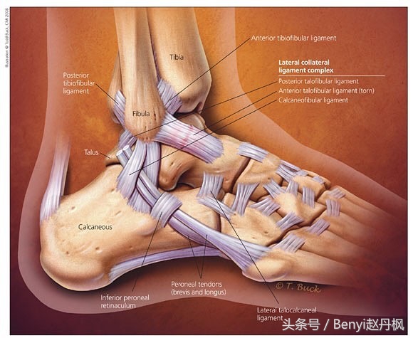 脚踝受伤半年后如何康复训练,脚踝伤病的六个问题