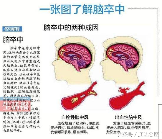2025年，这个病预计增长3倍！听专家咋警示！