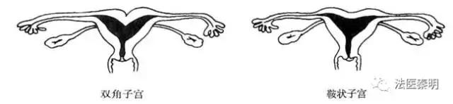 女人有两个子宫怎么办呢,来大姨妈可以同宫吗