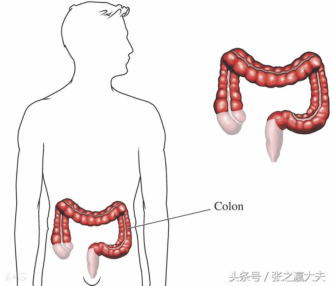 清宿便排肠毒对身体的危害,清肠道排宿便致癌