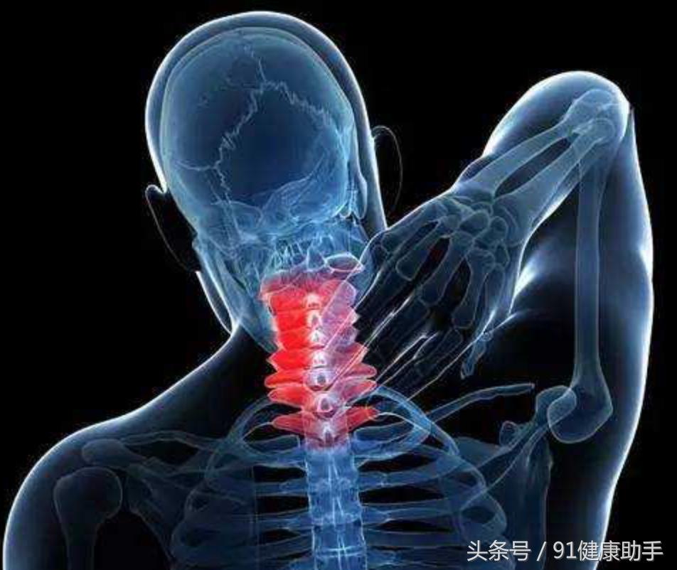 颈椎脊椎的自我治疗方法,脊椎型颈椎病如何问诊