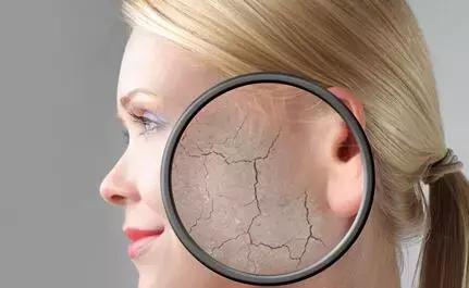 30岁美女大吼两声出现肋骨骨折，医生说这个病有点麻烦！