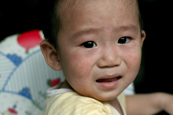 幼儿急疹全攻略动画,宝宝急疹指南