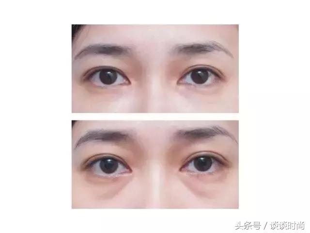 遮黑眼圈泪沟快速教程,新手如何遮泪沟黑眼圈