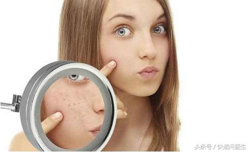 怎样祛除痘印痘坑小妙招,如何有效快速祛除痘印的方法