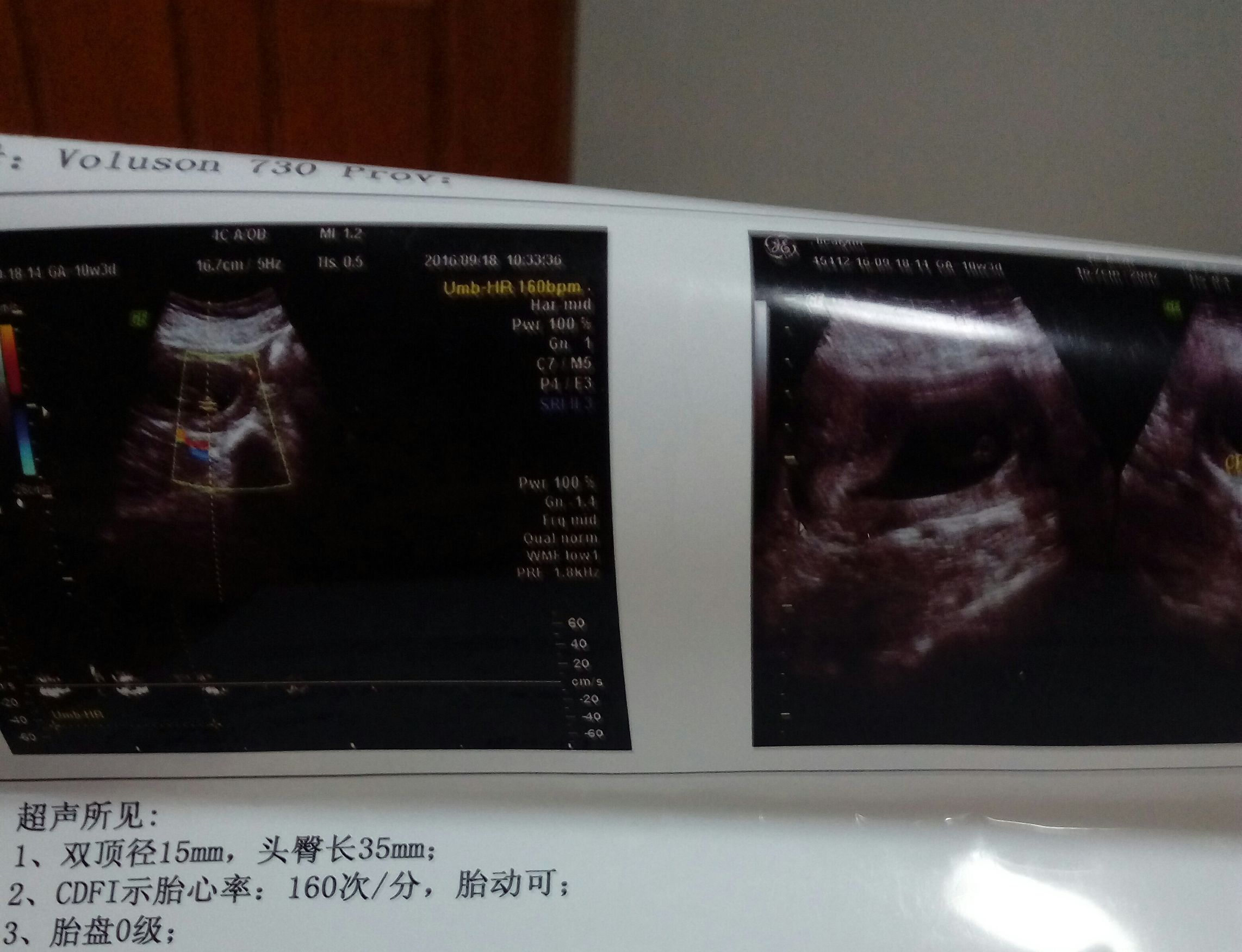 什么样的症状有可能怀孕，怀孕早期怎么缓解身体的不适