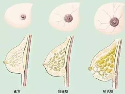 怀孕了乳房胀痛怎么办,怀孕多久出现乳房胀痛
