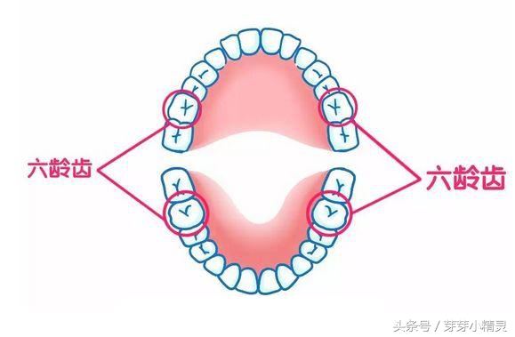 六龄齿牙齿终生不换,六龄牙坏了一半最有效的方法