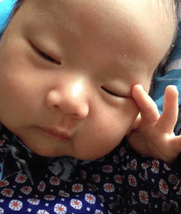 3个月的小宝宝容易长湿疹,刚出生宝宝一脸湿疹