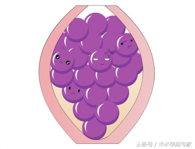 孕早期b超见胎心胎芽,孕早期如何从b超单上分辨婴儿