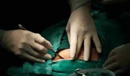 剖腹产一周后产妇伤口崩开,剖腹产刀口崩裂怎么处理