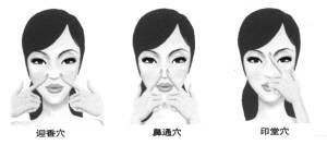 治疗鼻炎流清鼻涕最好办法,止鼻炎流清鼻涕中医小妙招